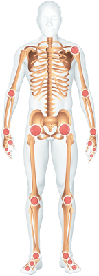 RheumatischeErkrankungen RheumatischeErkrankungen
