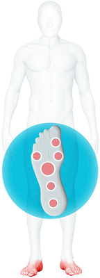 Fuß-erkrankungen Fuß-erkrankungen