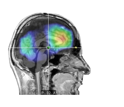 Concentration Concentration